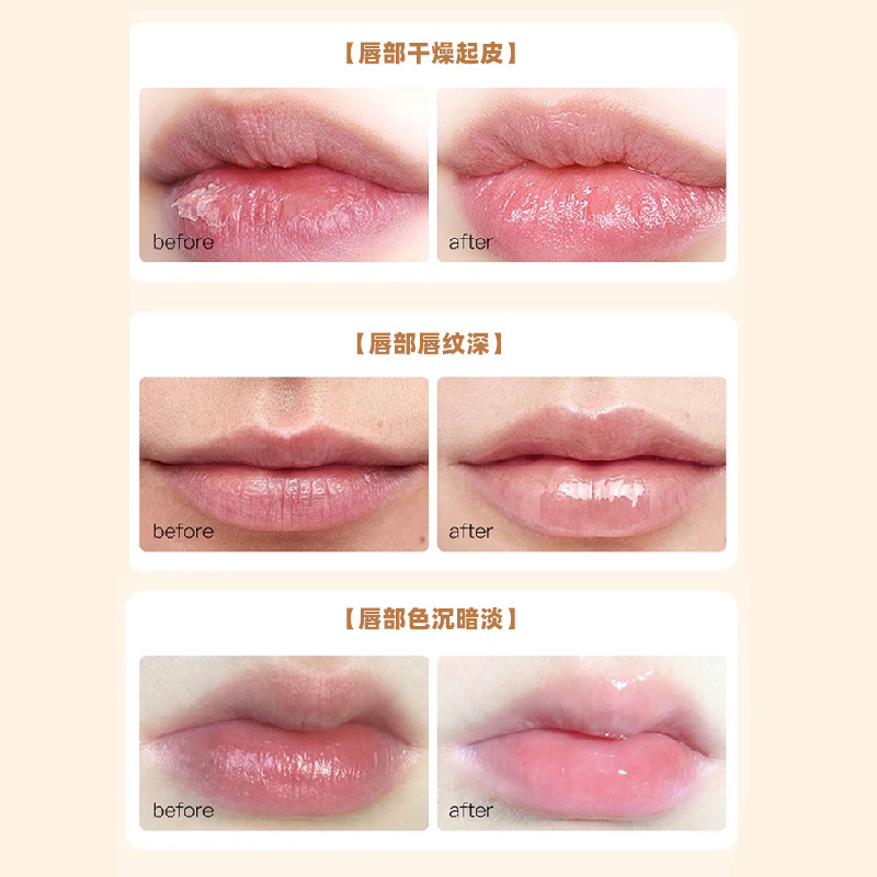 5ml Aromatic Essential Oil Lip Care Essence Oil Essence Oil Lip Ointment Lip Oil Lip Balm Care Moisturizing and Plumping