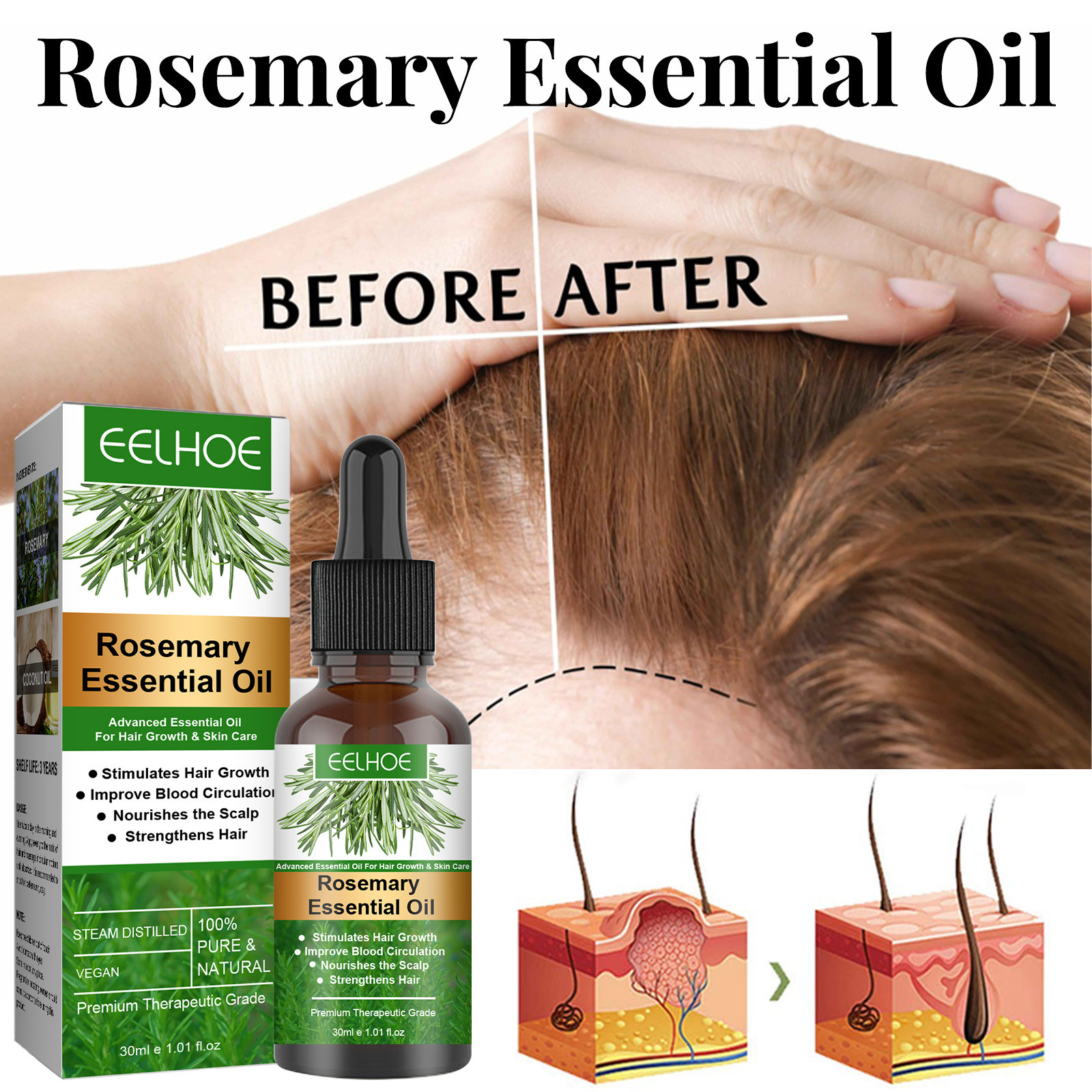 EELHOE Rosemary Hair Care Essential Oil Anti-Hair Growth Essential Oil Anti-Hair Care Nourishing Scalp Essential Oil