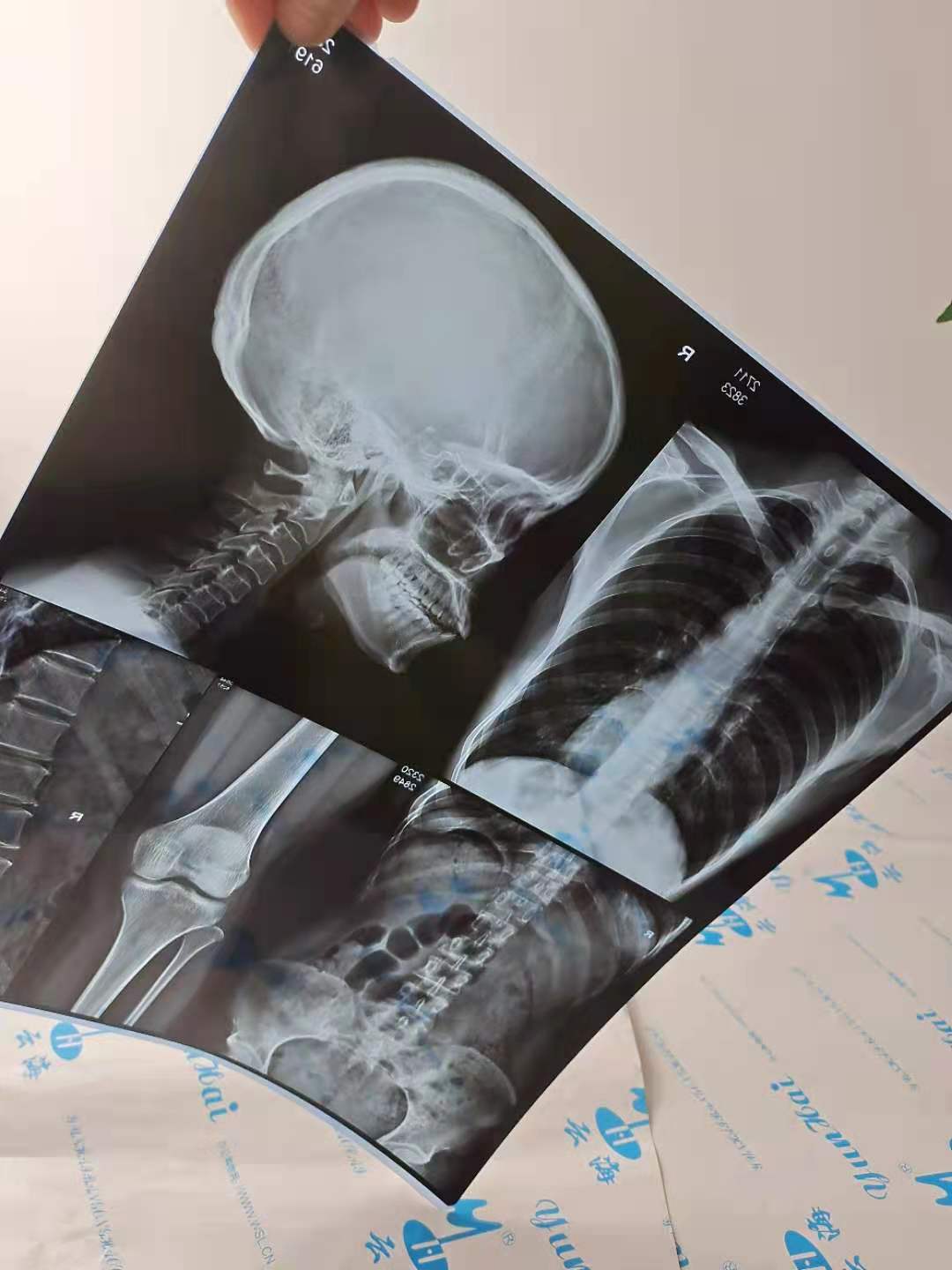 14x17 blue base blue thermal film ct cr dr mri mri mri radiology medical film cloud sea