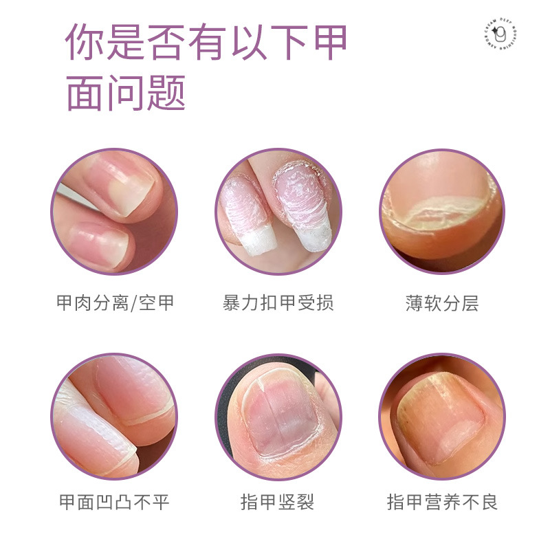 Nail Cream Source Manufacturer, Manicure Care Cream, Nutritional Oil, Nail Care, Brightening Nail Surface, Manicure Finger Edge Oil Factory