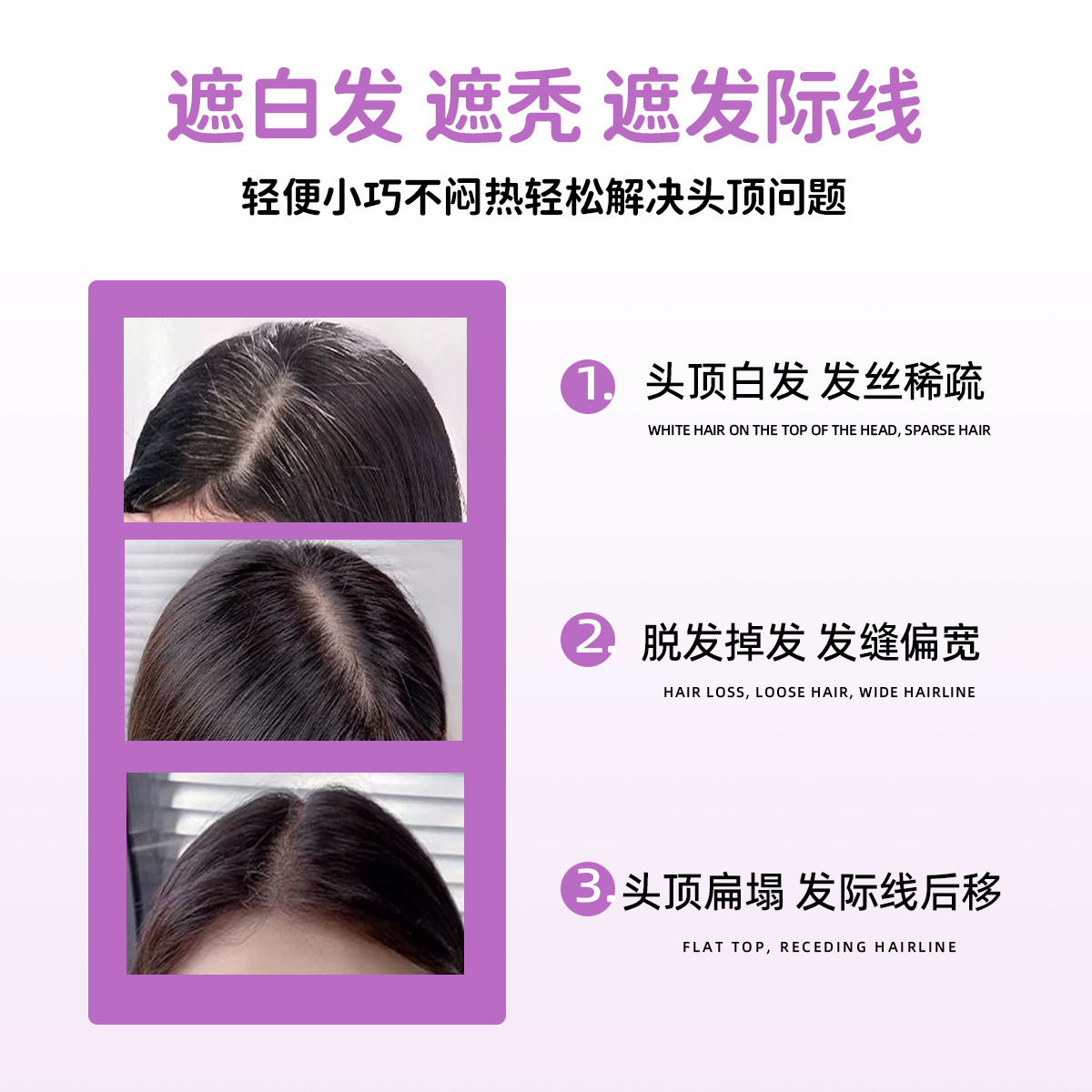 Wig for Women with Braided Bangs, Real Hair Forehead, Seamless Hairband to Cover White Hair, White Hair Covering Artifact on Top of Head