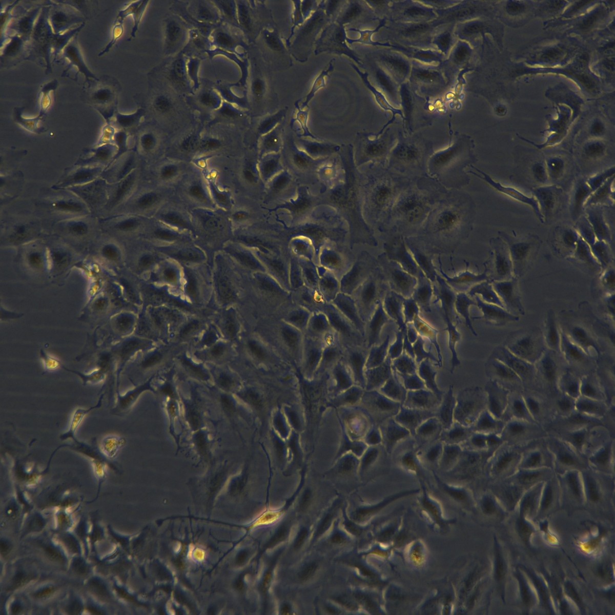 Meisenctcc Human Bile Duct/Cancer Fluorouracil Resistant Strain Rbe/5-Fu