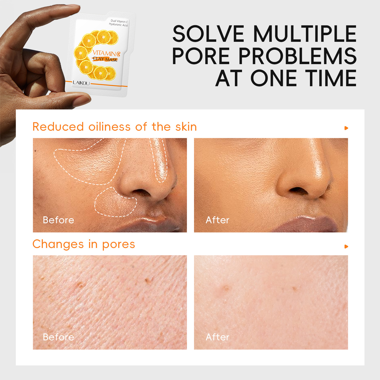 Cross-Border Spot New Product Laikou Vitamin C Mud Mask Sheet 5g Single Piece Cleansing Pores Smear Mask Export