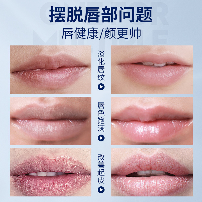 Vitus Vaseline Men's Lip Balm Moisturizing, Non-Greasy, Anti-Drying, Genuine Men's and Women's Lip Balm