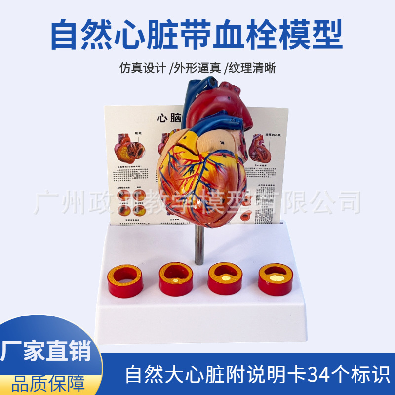 Стандартная модель человеческого сердца, анатомическая, съемная, учебная, натуральное большое сердце с моделью кровеносного сосуда и тромбом