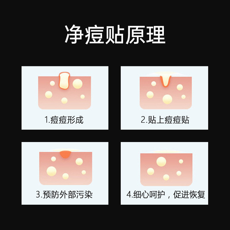 Cartoon Cat 20 Cute Pimple Patch Acne Covering Pus Absorbing Santa Claus 24 Cover Cross-border AliExpress in stock