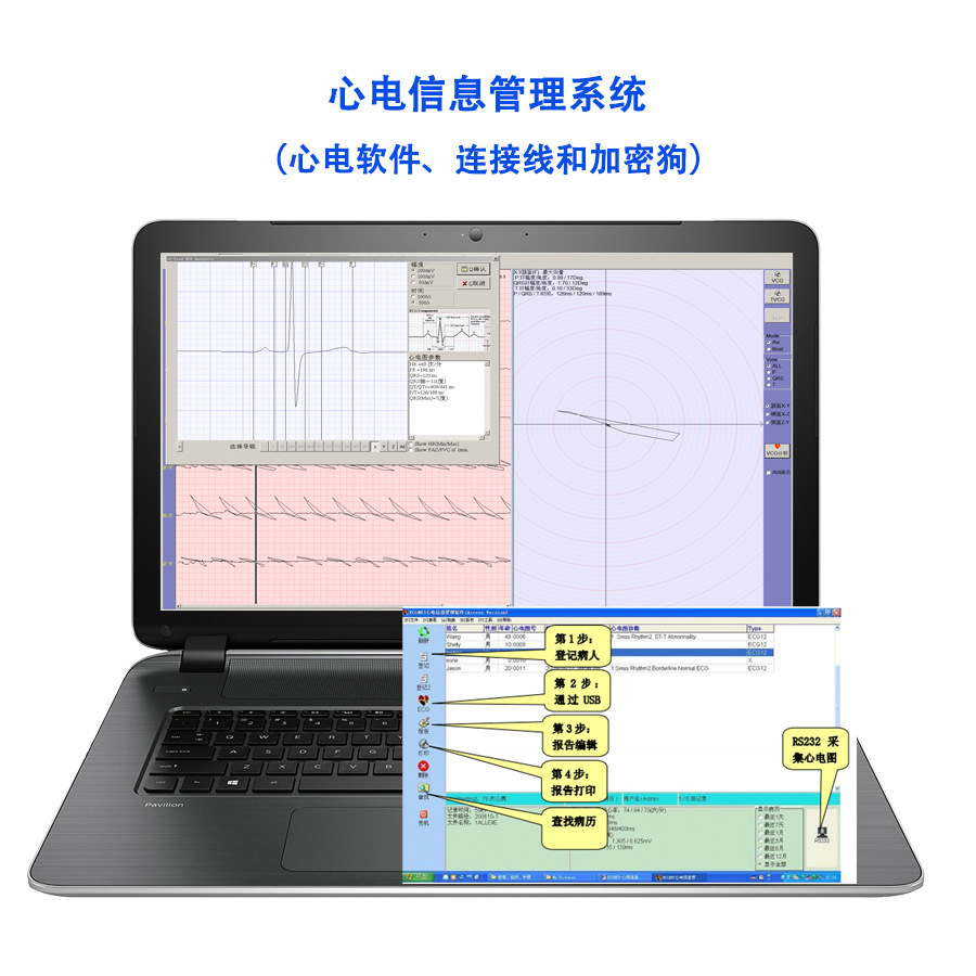 ЭКГ-аппарат Three Sharp, специализированная система управления информацией ЭКГ, рабочая станция ЭКГ