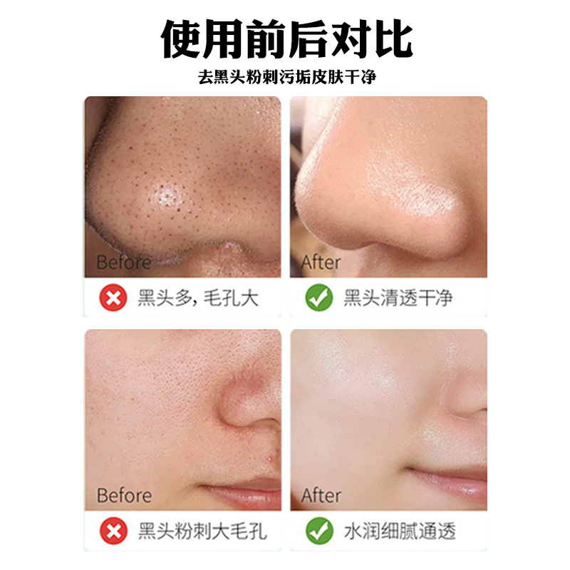 Blackhead Removal Nose Patch Processing Nose Patch Spot Wholesale Blackhead Patch Factory Acne Patch Single Piece Black Nose Patch Packaging