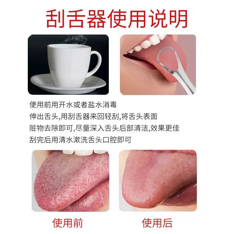 Stainless Steel Tongue Scraper, Oral Tongue Coating Cleaner, Adult Bad Breath Removal Tongue Scraper, U-Shaped Tongue Scraper