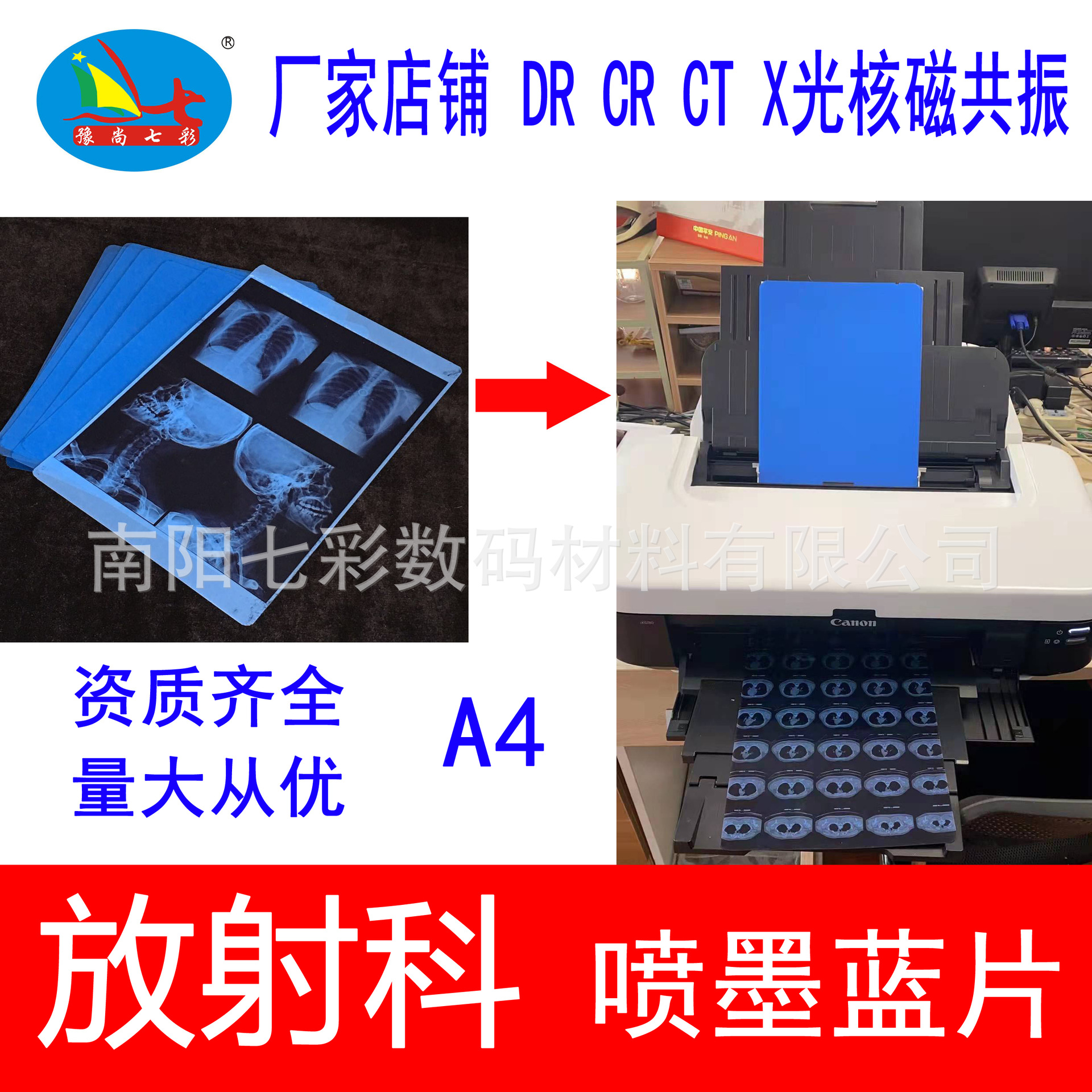 Оптовая продажа A4 медицинской пленки для печати с синей основой, пленка для печати в ортопедическом отделе