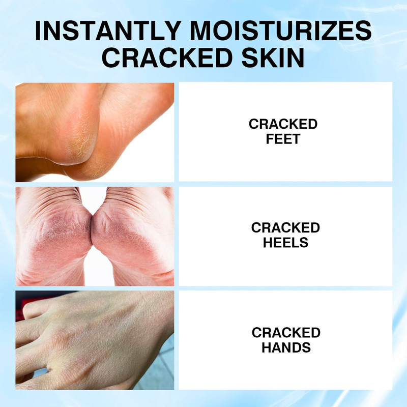 Cross-Border Hot-Selling Heel Stick, Foreign Trade Heel Dry and Cracked Foot Care Stick, Hydrating, Moisturizing, Anti-Chapped Care Stick