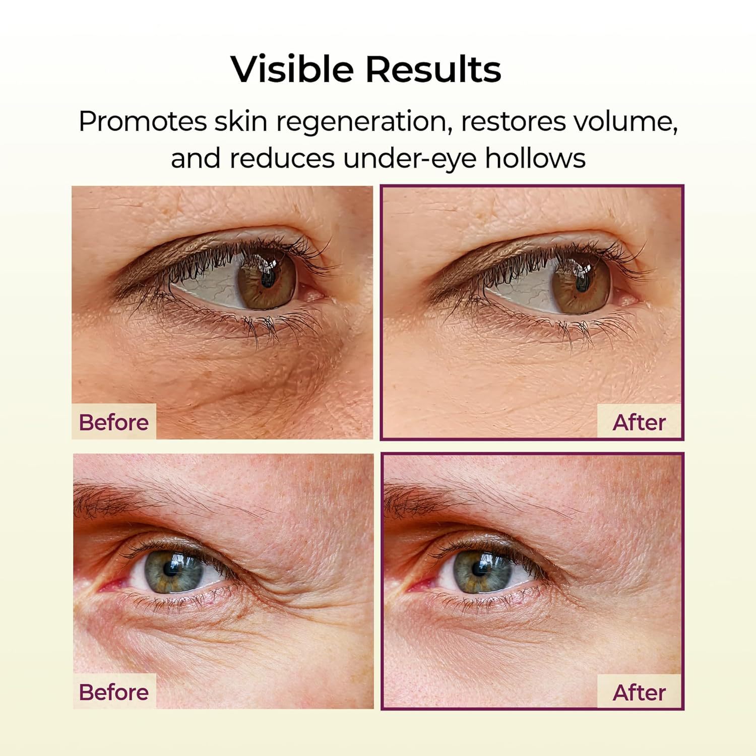 Cross-Border Popular Eye Cream Stick Dark Circle Eye Cream Stick Lifting Firming Eye Cream Customization