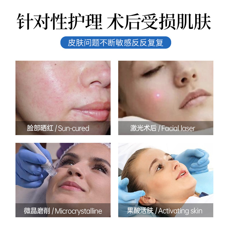 Cold application and antipyretic patch mask type hydrating and moisturizing sterile water light needle laser application beauty salon offline mask
