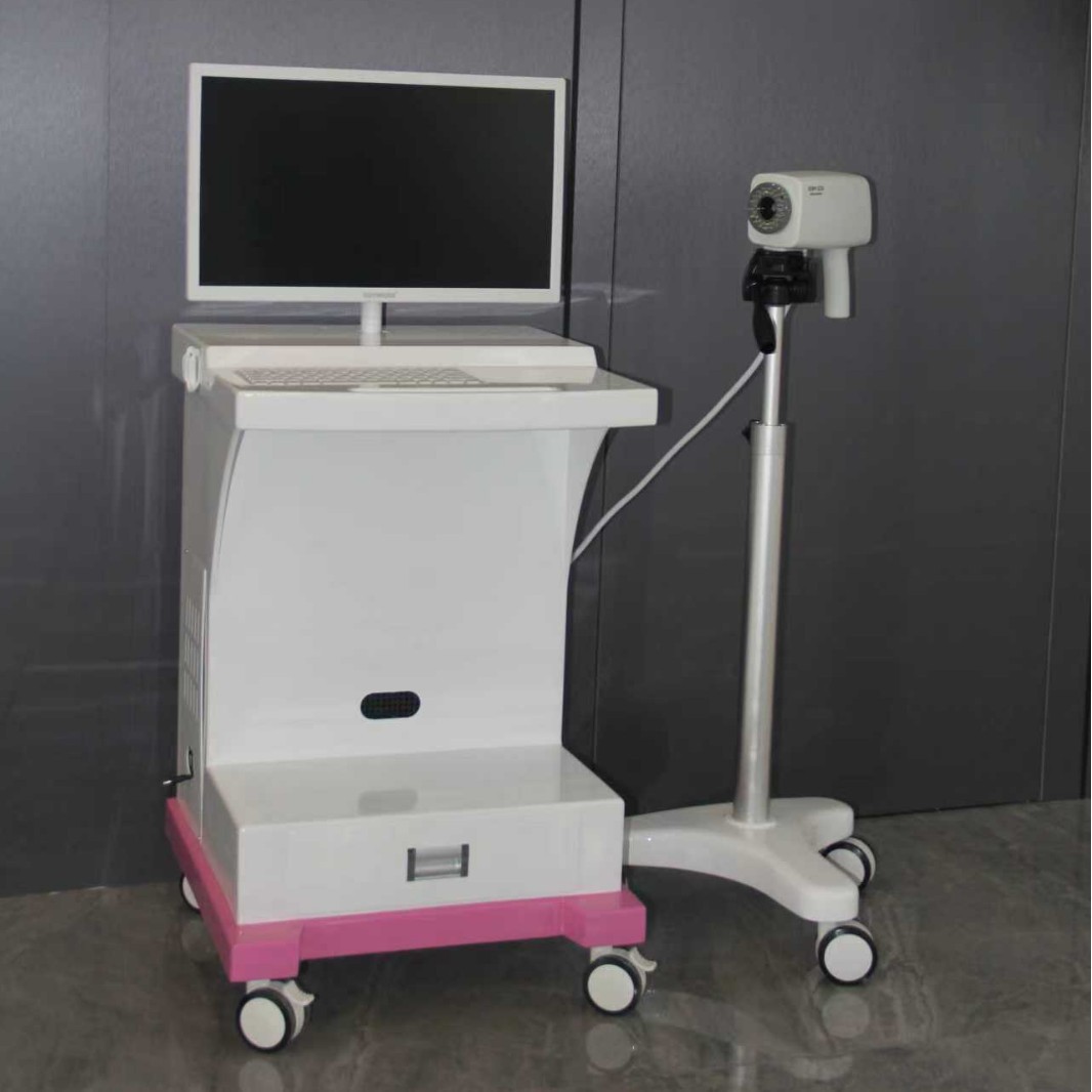 Xuzhou Xinma Manufacturer Electronic Colposcope Manufacturer 6000 Private Gynecological Examination Instrument 019 Installation Fee