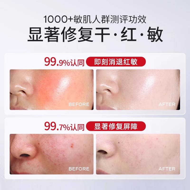 Class II Device Products Medical Spray Emulsion Essence Repair Cream Aseptic Medical Grade Mechanical Size Skin Care Products