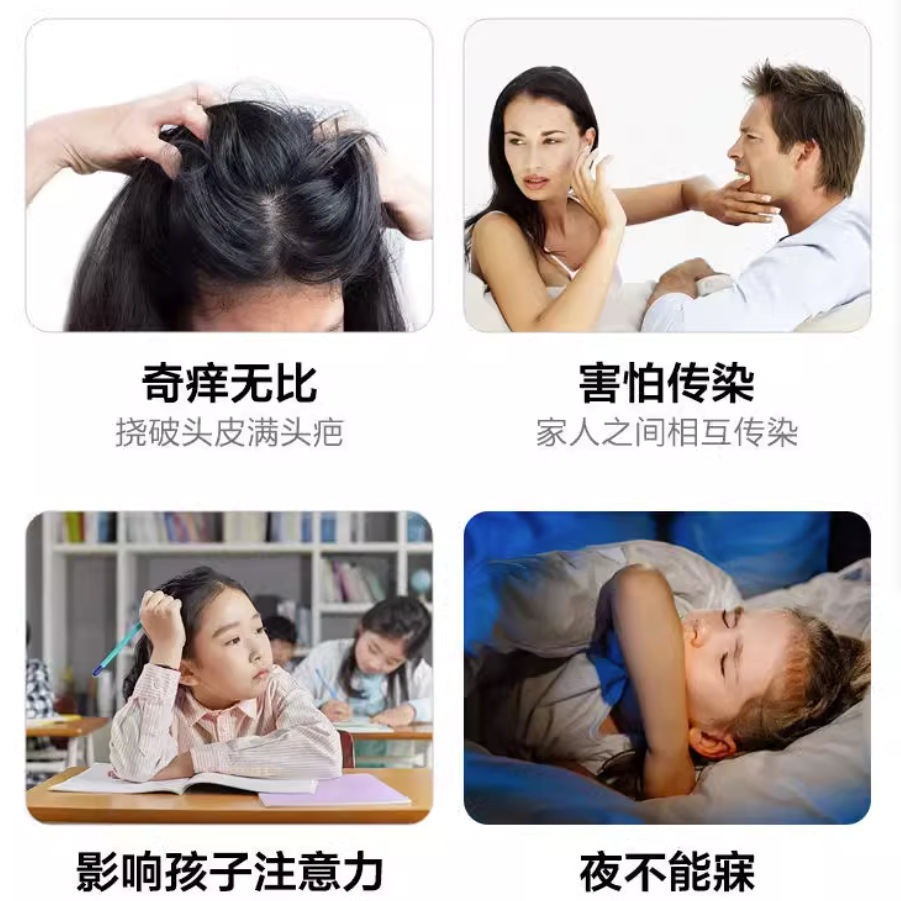 Renhe Compound Bulb Tincture Spray for Scabies, Instantly Removes Lice and Mites, Gentle 70ml, One Piece Dropshipping