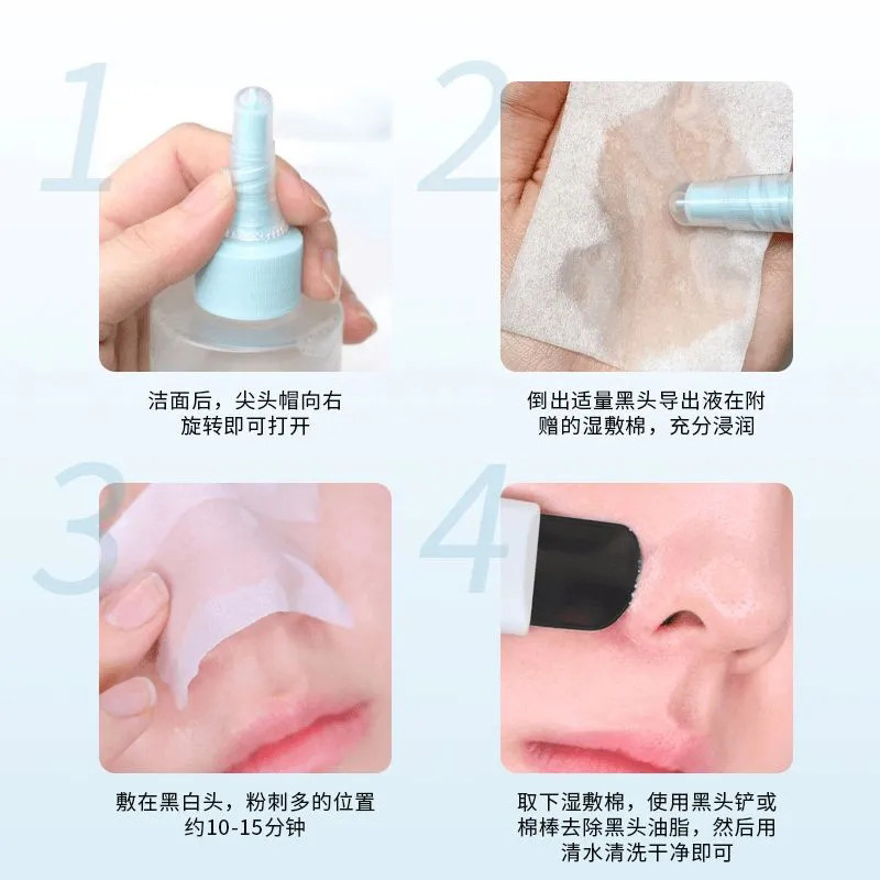Su Xiu Chen's Blackhead Lead Liquid Shrinks Pores Deep Cleansing of Pimples Blackhead Close Gentle Care Not Stimulating