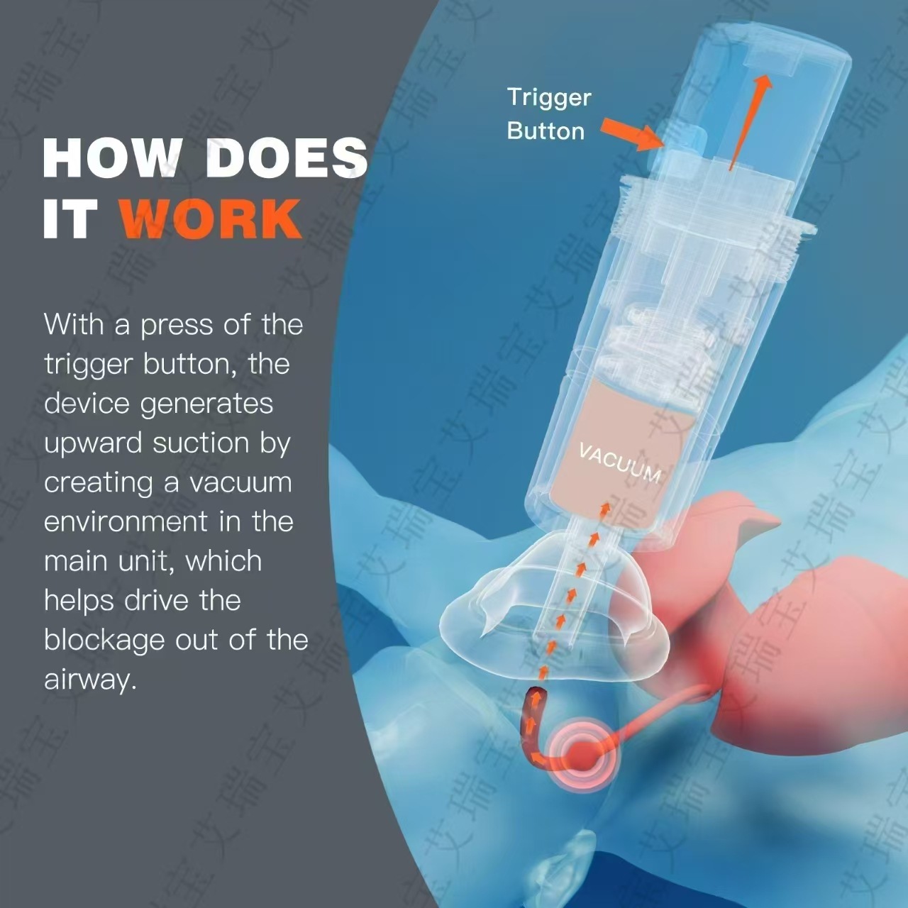 Sonmol Choking rescue device Heimlich Anti-choking Instrument Cross-border Foreign Trade Edition Anti-choking Instrument