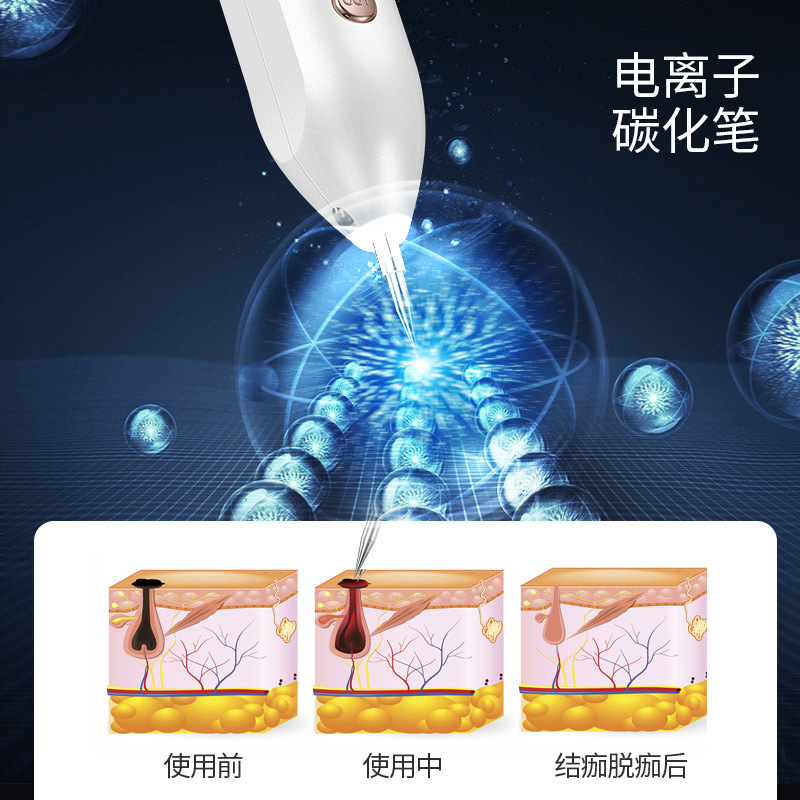 Source Factory Spot Removal Pen Mole Removal Pen Mole Removal Pen Spot Sweeper Beauty Instrument Spot Removal Pen Blue Light Acne Removal Pen