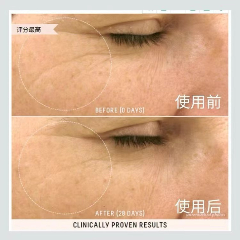 Cross-Border Biossance Squalane Rose Essence Oil Vc Vitamin Powder Brightening Exquisite Essence 30ml