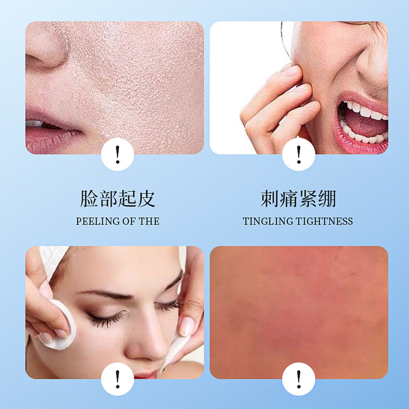 Yapin Vitamin E Skin Care Glycerin Makeup Niacinamide Body Lotion Moisturizing Dry Skin Whole Body Moisturizing Essence Water Hydrating