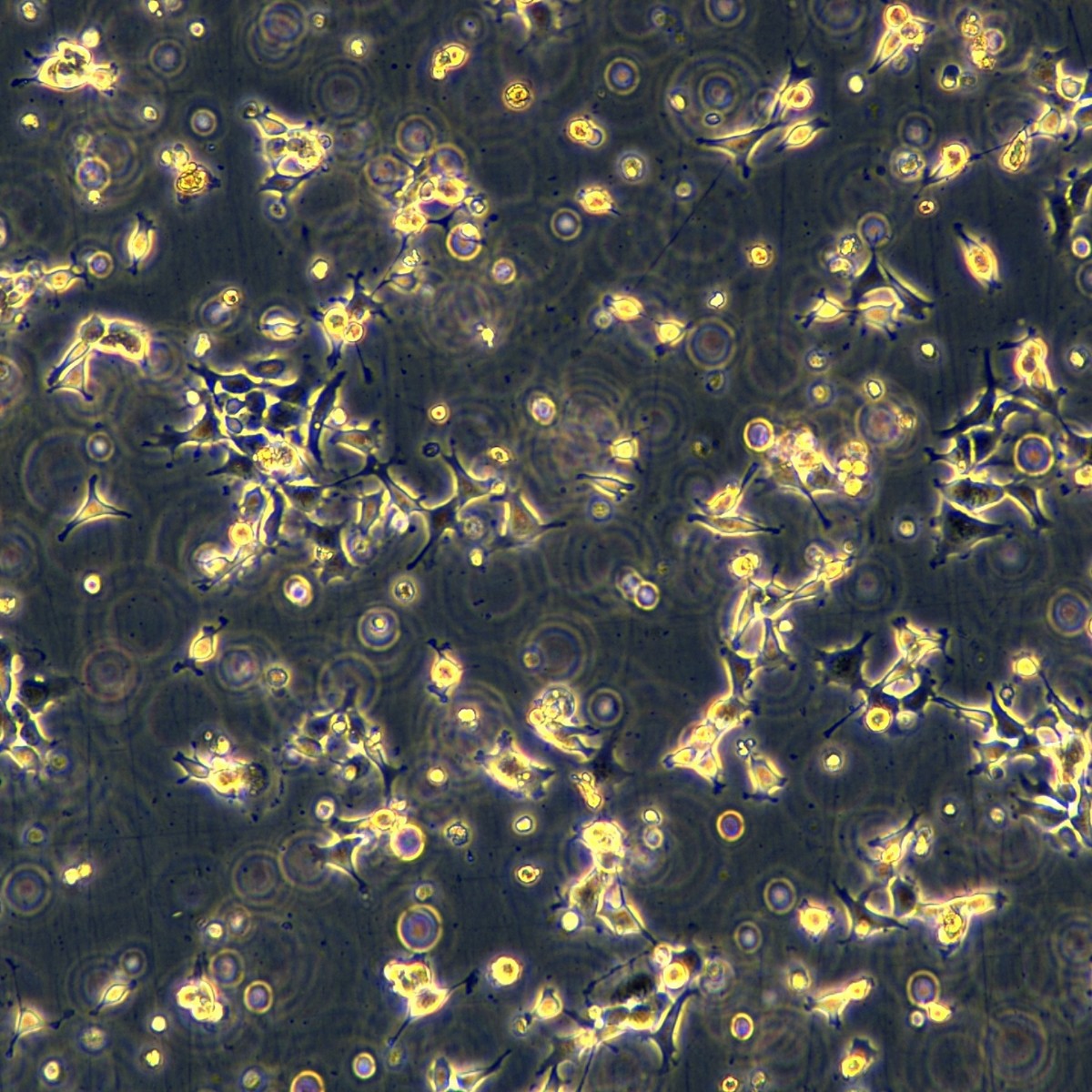 Meisenctcc Meisen Human Oropharyngeal Squamous Cell Carcinoma Cisplatin-Resistant Strain Fadu/Ddp