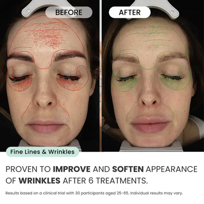 Cross-Border Hot-Selling Micro-Injection Facial Essence Set Firming Anti-Wrinkle Brightening Hydrating Essence Facial Set Oem