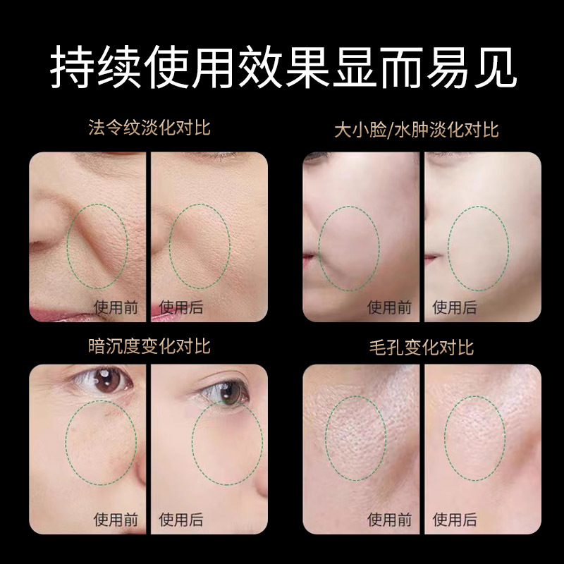 Collagen gun introduction instrument beauty instrument face lifting and tightening home massage portable EMS red light introduction instrument