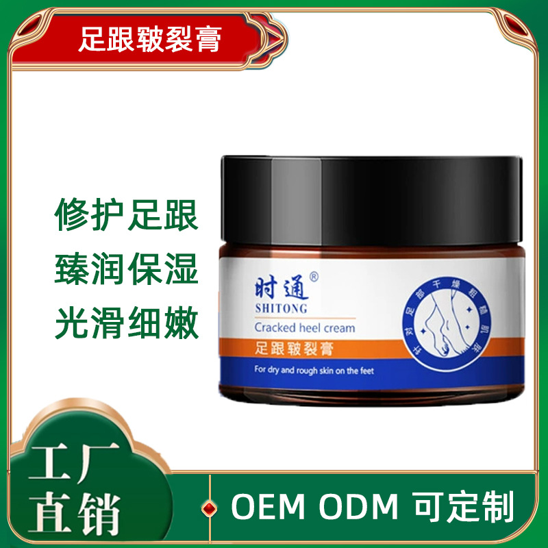When the foot chapped heel crack cream can ning chapped crack anti-dry crack cream moisturizing hand foot opening crack hand cream