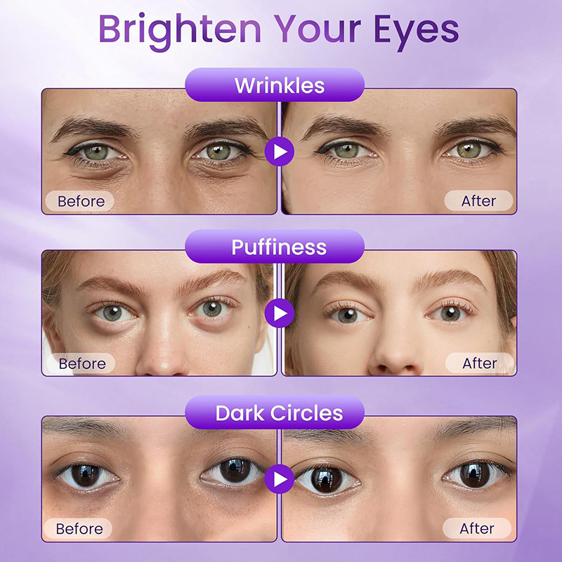 Cross-Border Retinol Firming Eye Cream Fades Dark Circles and Fine Lines Around the Eyes, Firming the Skin Around the Eyes Retinol Eye