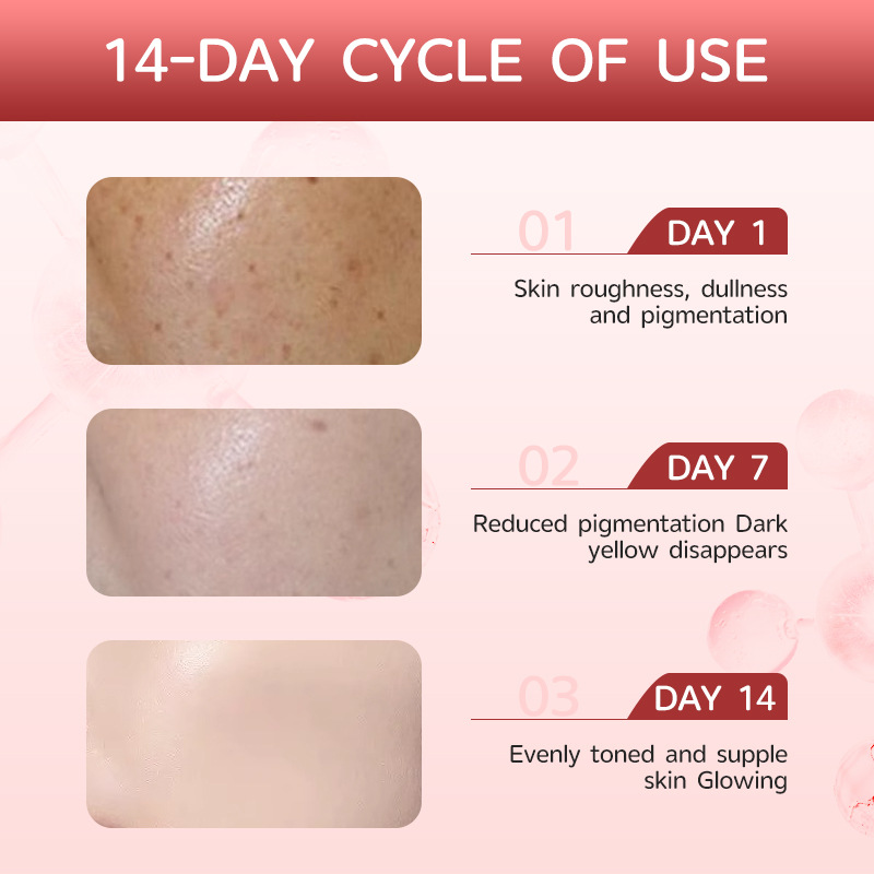 Spotlight on Dark Spots Reducing Serum with Niacinamide to Brighten Facial Skin, Original Serum for Hydrating, Moisturizing and Brightening Skin Tone