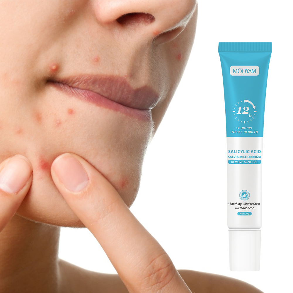 Cross-Border Spot Salicylic Acid Acne Soothing Gel to Fade Acne Marks, Remove Acne, Close Acne, and Remove Acne Cream