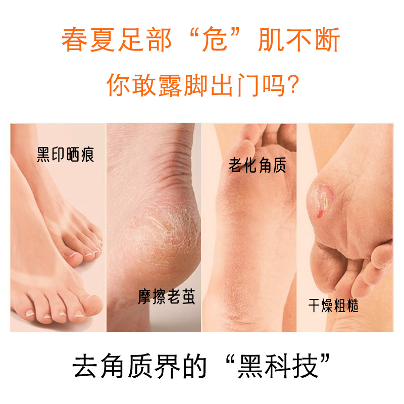 Bees Exfoliating Spray Foot Care Elbow Knee Exfoliation Dead Skin Calluses Remove Foot Skin Horse Oil Supports Delivery