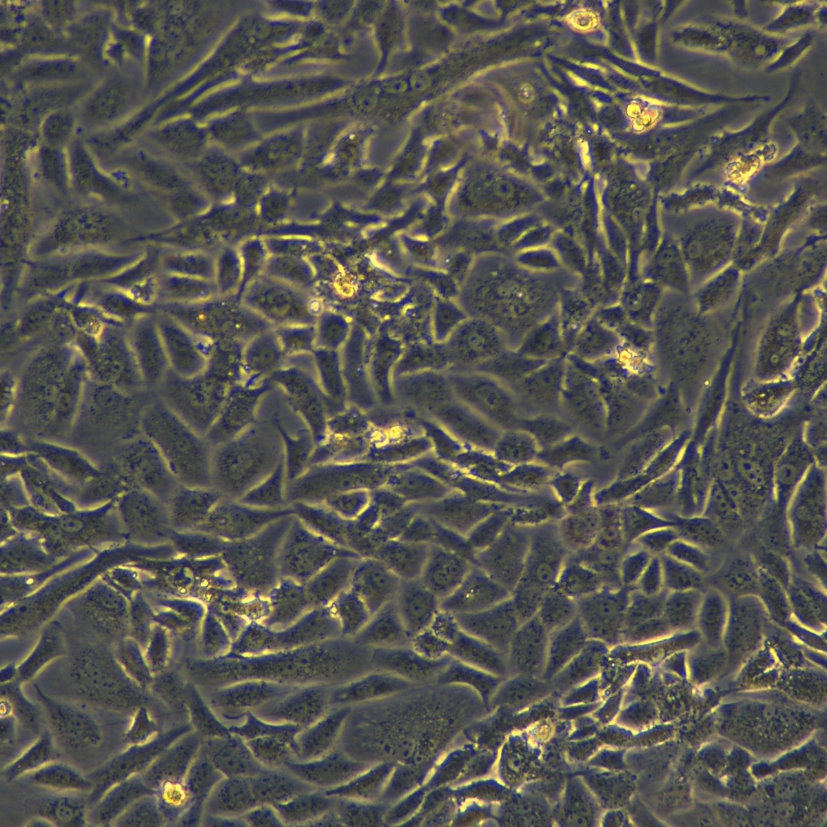Meisen Ctcc Meisen клетки низкодифференцированной аденокарциномы легких человека Sk-Lu-1