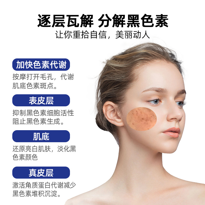 Five days bare-handed spot removal cream chloasma leather spot spot cream freckles whitening cream fried spot cream cosmetics