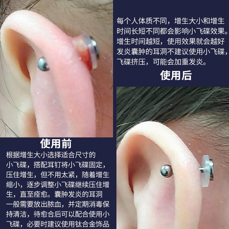 Small Flying Saucer Food-Grade Silicone Transparent Anti-Hyperplasia Ear Bone Nail Ear Piercing Ear Plug Soft Gasket Anti-Internalization Cochlear Nail