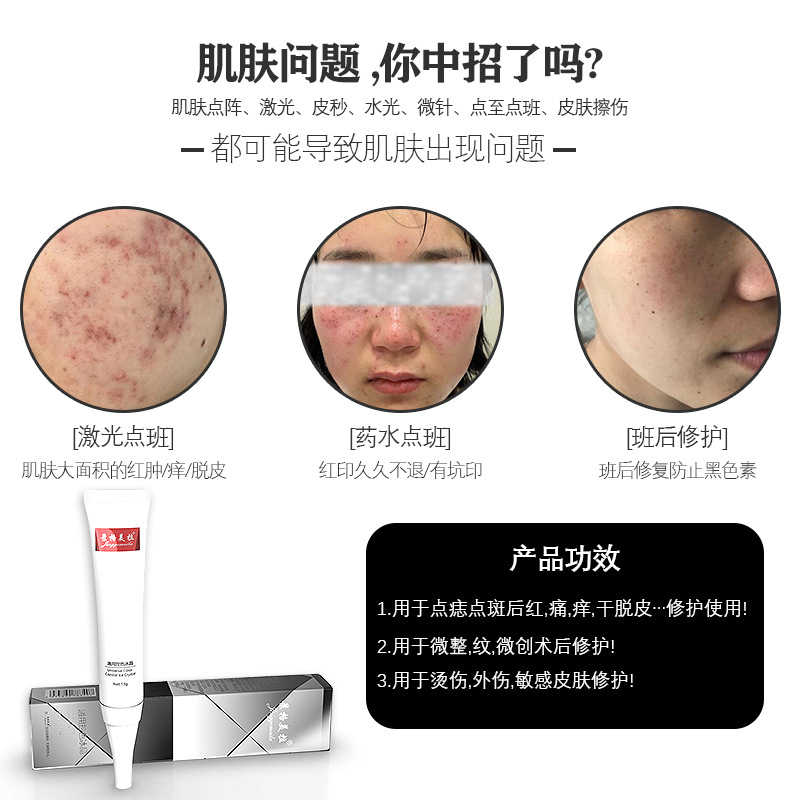 Jingge Meila universal color control ice crystal beauty salon mole removal laser mole removal spot Special Repair repair agent liquid