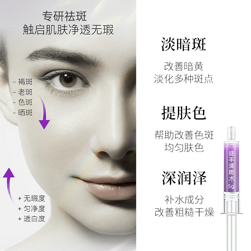 Five-Day Freehand Freckle Removal Cream Whitening Freckle Cream Chloasma Dermal Spot Freckle Cream Cosmetics Rejuvenation