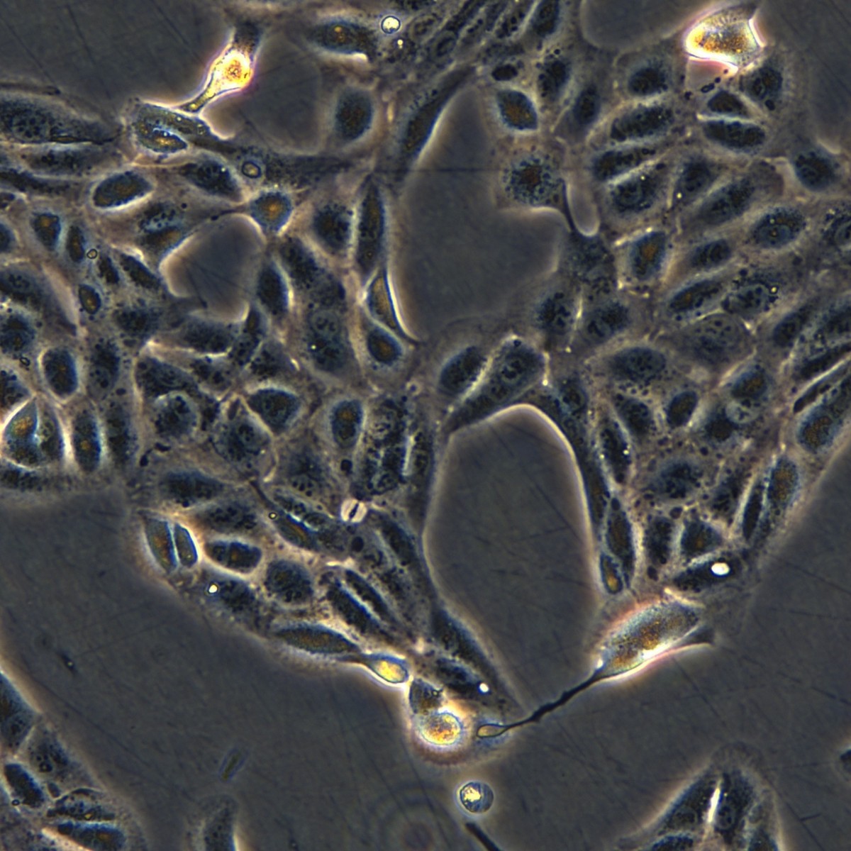 Meisen Ctcc Meisen Human Renal Cell Adenocarcinoma Sorafenib Resistant Strain Achn/Sorafenib