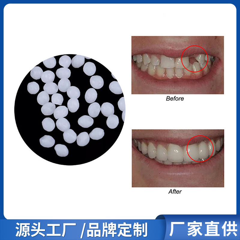 Оптовая продажа солидных сосательных пленок и временных зубных пломб, модификация зубных протезов