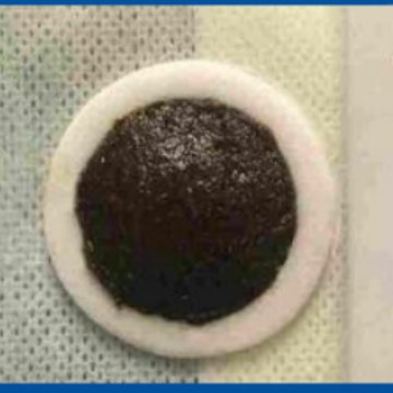 Бренд медицинского класса I Акупунктурный патч для детей 8X8 Стимуляция давления при простудах, диарее, кашле и астме