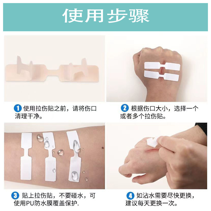 Source Factory Seam-free Wound Patch Band-aid Seam-free Needle Pulling Band-aid Outdoor Wound Quick Suture Patch