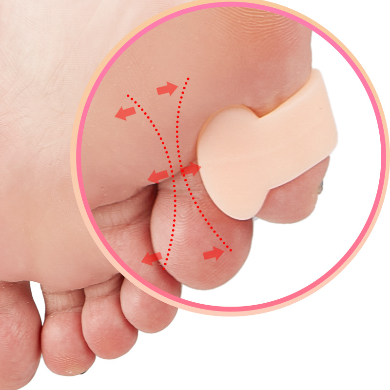 Small toe valgus orthosis overlapping toe toe splitter tail toe clip toe protector anti-wear toe sleeve