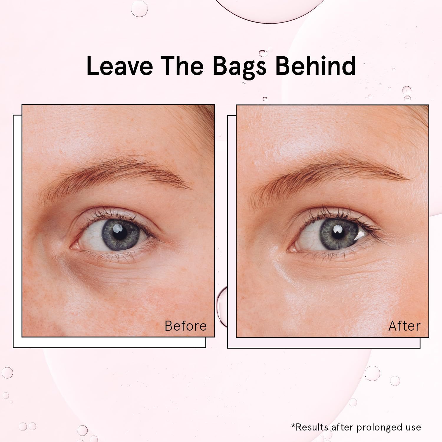 Amazon's Best-Selling Eye Roller Essence Improves the Eye Area, Fades Fine Lines, Tightens, Anti-Wrinkles and Brightens Oem Customization