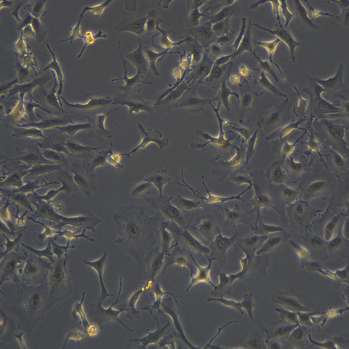 Meisenctcc человеческий желчный проток/рак, штам, устойчивый к флуороурацилу Rbe/5-Fu