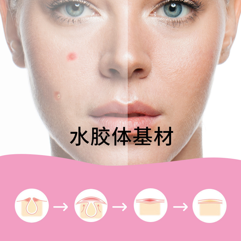 Color Star Pimple Patch Cross-border Multi-color Love Makeup Artificial Skin Protection Wound Acne Covering Chinese Bags
