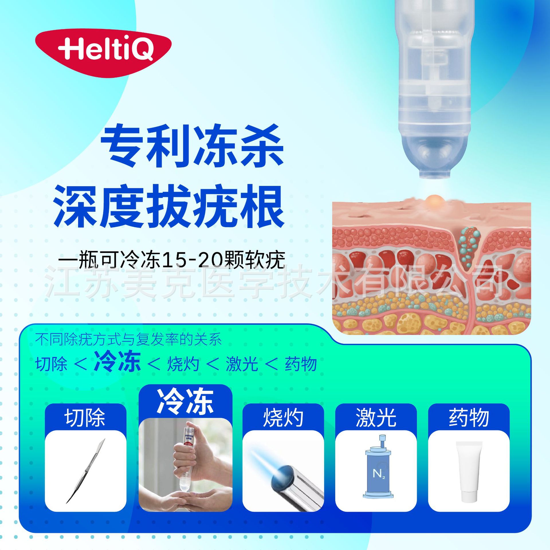 Hodyou Frozen Wart Removal Spray Type Ii Device Non-Medical Liquid Nitrogen Gel to Remove Warts Filamentous Warts Flat Warts Plantar