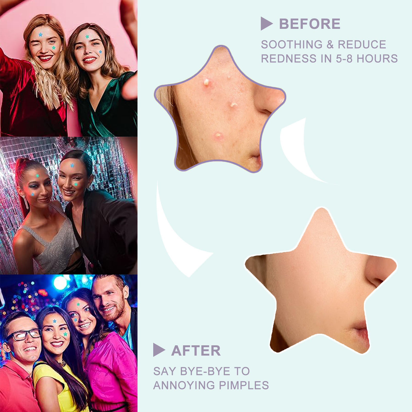 Laser five-pointed star acne patch to remove acne marks fast invisible acne patch to absorb pus and remove acne cover