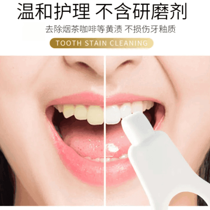 Tooth Cleaning Tool Stain-removing Artifact for Deep Tooth Cleaning for Teenagers Universal Portable Tooth Cleaning Wipe