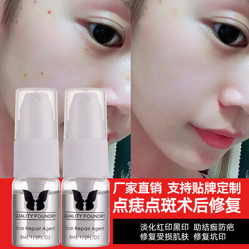 Special Mole Repair Agent for Spot Spots, Eyebrows, Eyes and Lips, Pattern Embroidery, Universal Repair, Ice Crystal to Prevent Coloring, Reflux and Calm the Seals